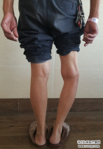 74歲老人換完關(guān)節(jié)要出院這天，“糾纏”了關(guān)節(jié)科主任半天……