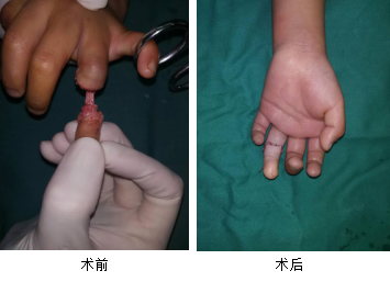 <a href='http://www.cuzhaopin.cn/' target='_blank'><u>徐州仁慈醫(yī)院</u></a>手外科
