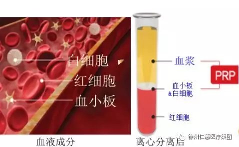 仁慈創(chuàng)面修復