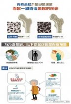 【活動通知】世界骨質疏松日徐州