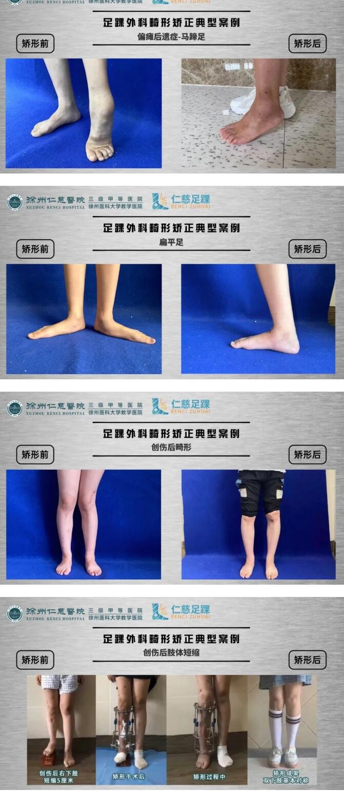 徐州仁慈醫(yī)院