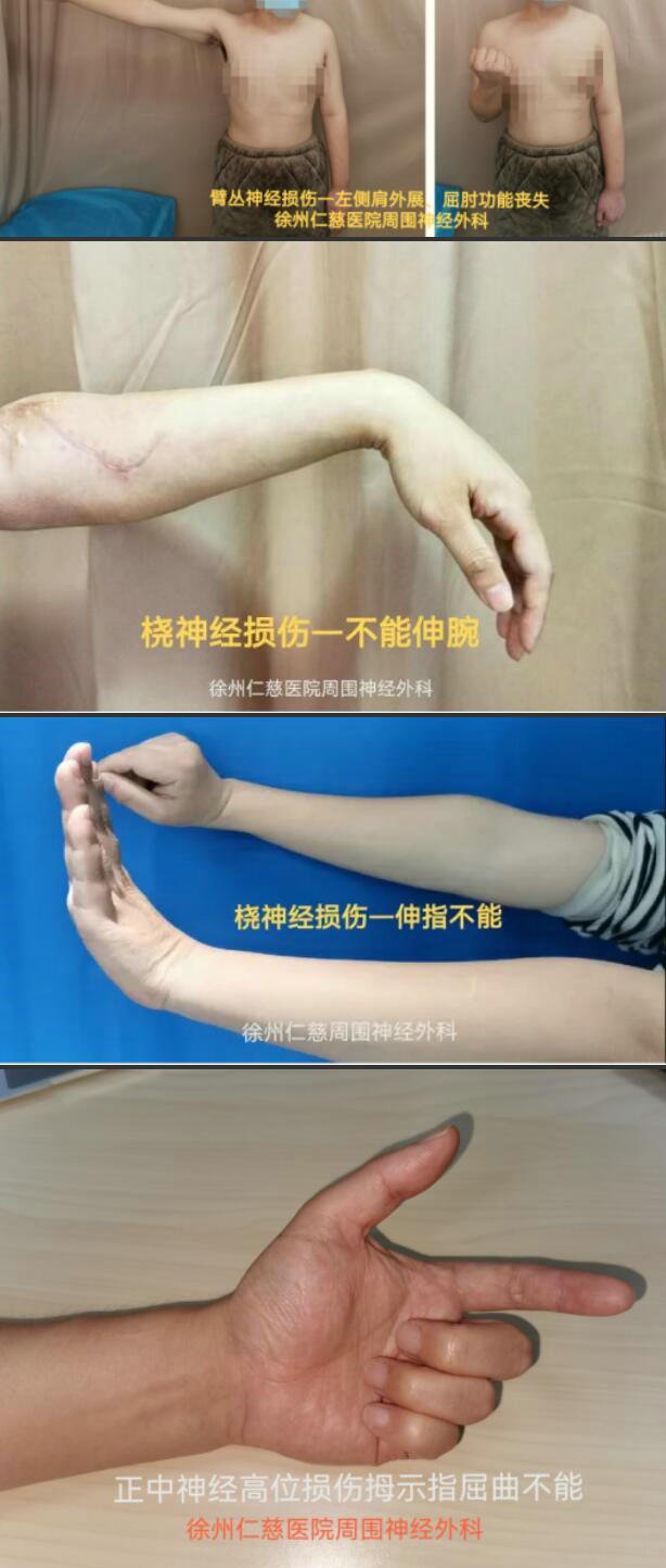 徐州仁慈醫(yī)院